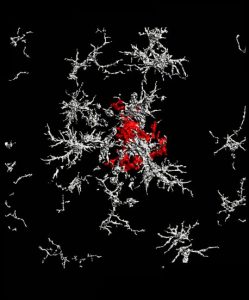 dense-core amyloid-beta plaque (red) surrounded by microglia (white)